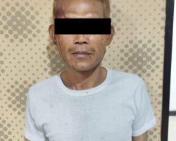 Motif Cemburu, Pria Siram Air Keras ke Dua Korban Berhasil Ditangkap Polsek Kemayoran