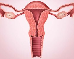 Fenomena Rahim Copot: Kasus Langka yang Bikin Dokter Terkejut!