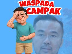 Kewaspadaan Campak di Sidoarjo Meningkat
